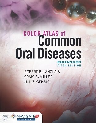 Color Atlas of Common Oral Diseases, Enhanced Edition - Robert P. Langlais, Craig S. Miller, Jill S. Gehrig