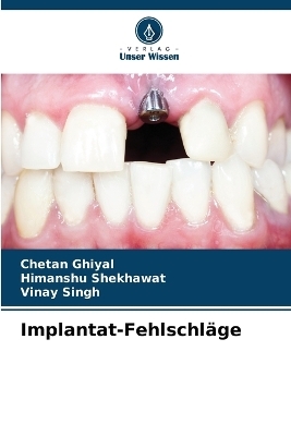 Implantat-Fehlschläge