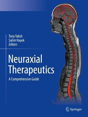 Neuraxial Therapeutics - 