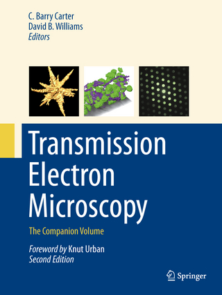 Transmission Electron Microscopy