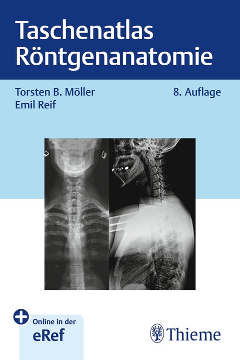 Taschenatlas R&ouml;ntgenanatomie - Torsten Bert M&ouml;ller, Emil Reif