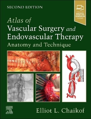 Atlas of Vascular Surgery and Endovascular Therapy - 