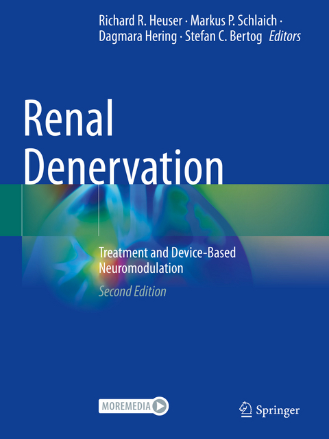 Renal Denervation - 