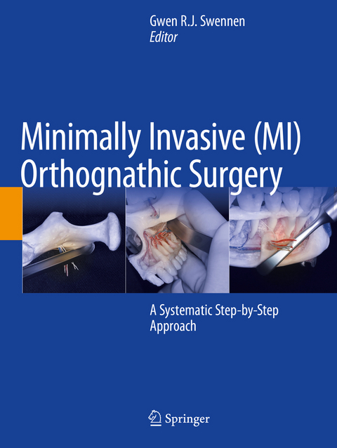 Minimally Invasive (MI) Orthognathic Surgery - 
