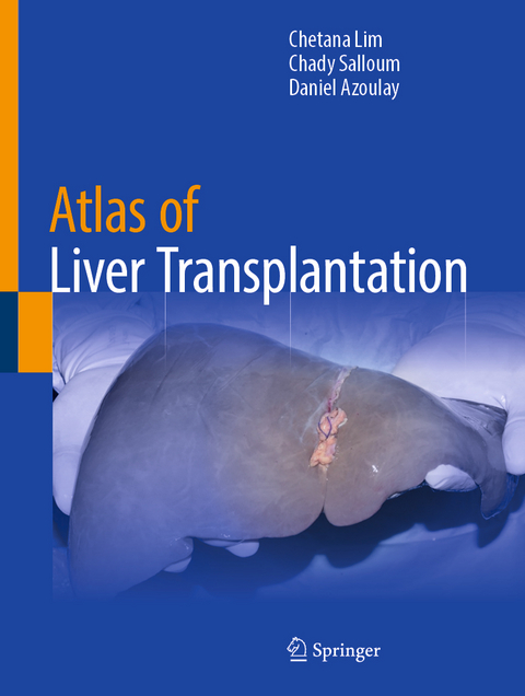 Atlas of Liver Transplantation - Chetana Lim, Chady Salloum, Daniel Azoulay
