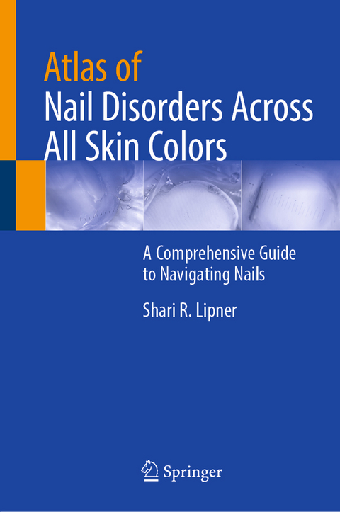 Atlas of Nail Disorders Across All Skin Colors - Shari R. Lipner