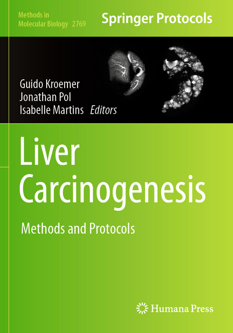 Liver Carcinogenesis - 