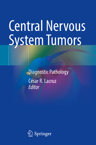Central Nervous System Tumors