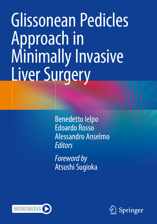 Glissonean Pedicles Approach in Minimally Invasive Liver Surgery