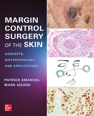 Margin Control Surgery of the Skin: Concepts, Histopathology, and Applications - Patrick Emanuel, Mark Izzard
