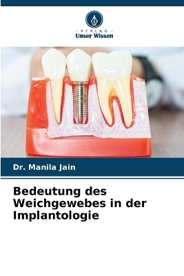 Bedeutung des Weichgewebes in der Implantologie - Dr Manila Jain