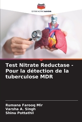 Test Nitrate Reductase - Pour la d&eacute;tection de la tuberculose MDR - Rumana Farooq Mir, Varsha A Singh, Shinu Pottathil
