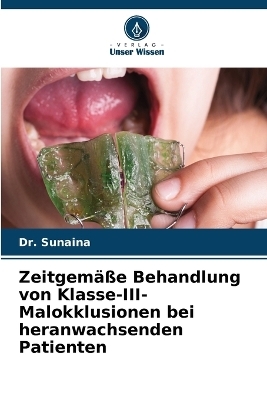 Zeitgem&auml;&szlig;e Behandlung von Klasse-III-Malokklusionen bei heranwachsenden Patienten - Dr Sunaina