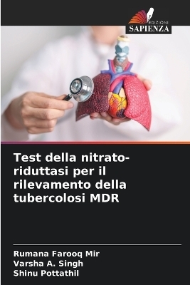 Test della nitrato-riduttasi per il rilevamento della tubercolosi MDR - Rumana Farooq Mir, Varsha A Singh, Shinu Pottathil