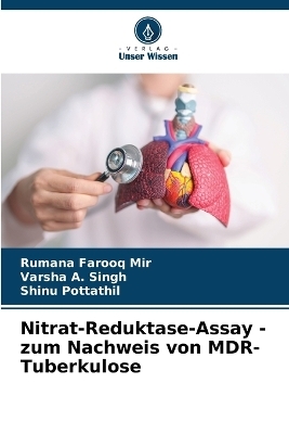Nitrat-Reduktase-Assay - zum Nachweis von MDR-Tuberkulose - Rumana Farooq Mir, Varsha A Singh, Shinu Pottathil