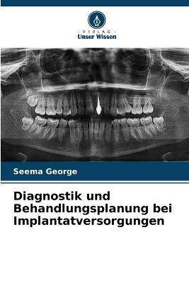 Diagnostik und Behandlungsplanung bei Implantatversorgungen - Seema George