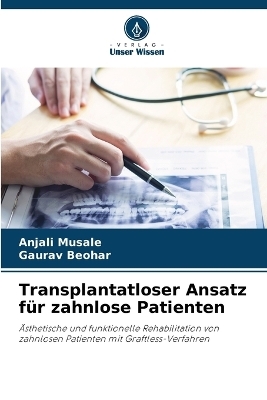 Transplantatloser Ansatz f&uuml;r zahnlose Patienten - Anjali Musale, Gaurav Beohar