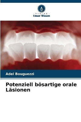 Potenziell b&ouml;sartige orale L&auml;sionen - Adel Bouguezzi
