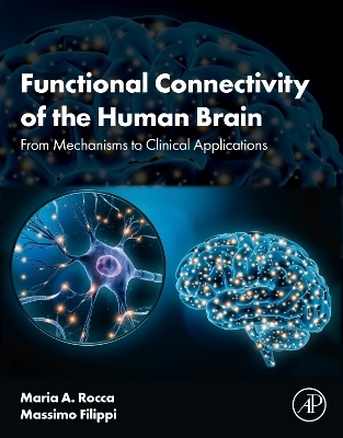 Functional Connectivity of the Human Brain