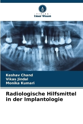 Radiologische Hilfsmittel in der Implantologie