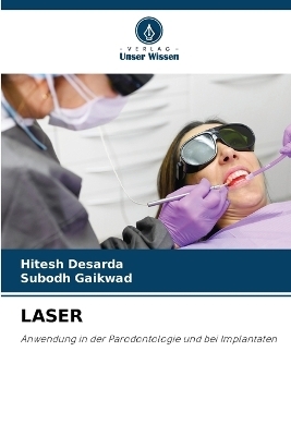 Laser