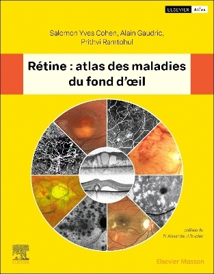 R&eacute;tine : atlas des maladies du fond d'oeil - Salomon Yves Cohen, Prithvi Ramtohul, Alain Gaudric
