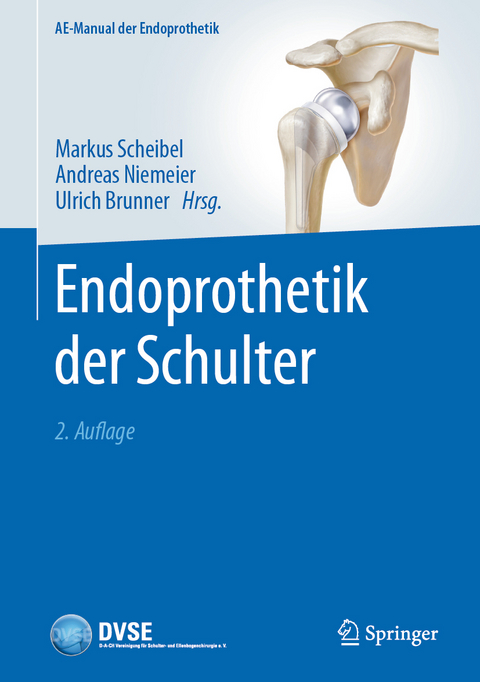 Endoprothetik der Schulter - 