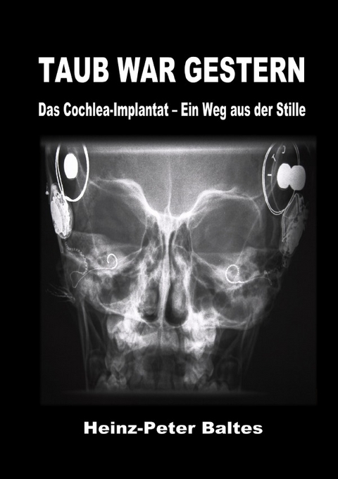 Taub war gestern - Heinz-Peter Baltes