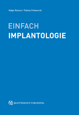 Einfach Implantologie - Claudio Cacaci, Tabea Fl&uuml;gge, Gerhard Iglhaut