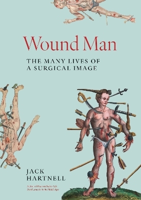 Wound Man - Jack Hartnell