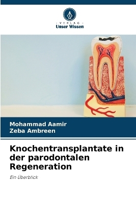 Knochentransplantate in der parodontalen Regeneration