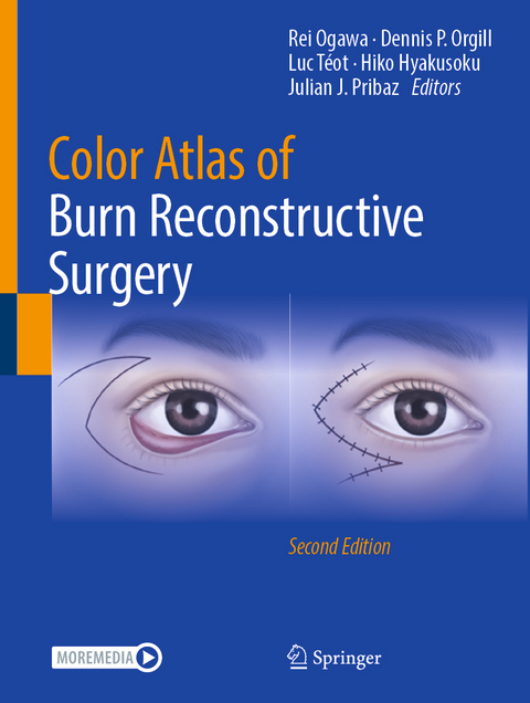 Color Atlas of Burn Reconstructive Surgery - 