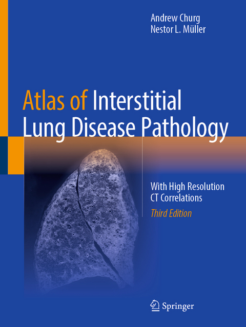 Atlas of Interstitial Lung Disease Pathology - Andrew Churg, Nestor L. M&uuml;ller