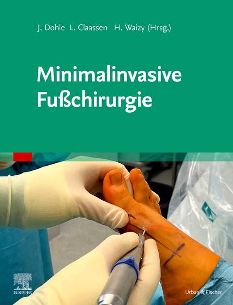 Minimalinvasive Fußchirurgie - 