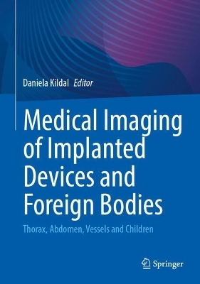 Medical Imaging of Implanted Devices and Foreign Bodies - 