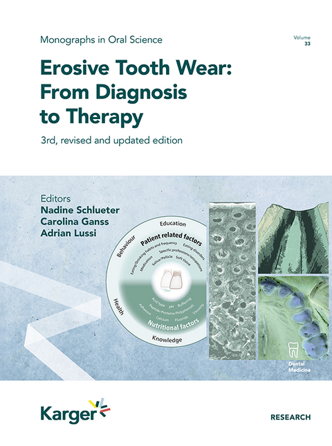 Erosive Tooth Wear: From Diagnosis to Therapy - 