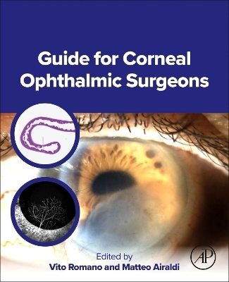 Guide for Corneal Ophthalmic Surgeons - 