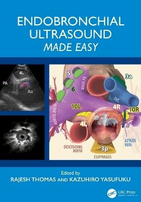 Endobronchial Ultrasound Made Easy - 