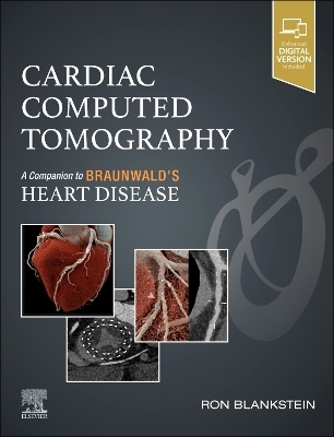 Cardiac Computed Tomography