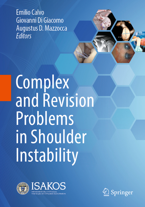 Complex and Revision Problems in Shoulder Instability - 
