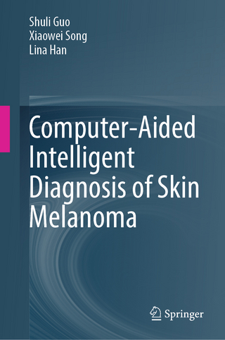 Computer-Aided Intelligent Diagnosis of Skin Melanoma