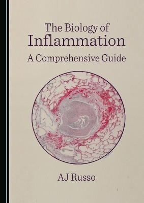 The Biology of Inflammation