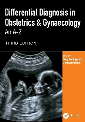 Differential Diagnosis in Obstetrics & Gynaecology
