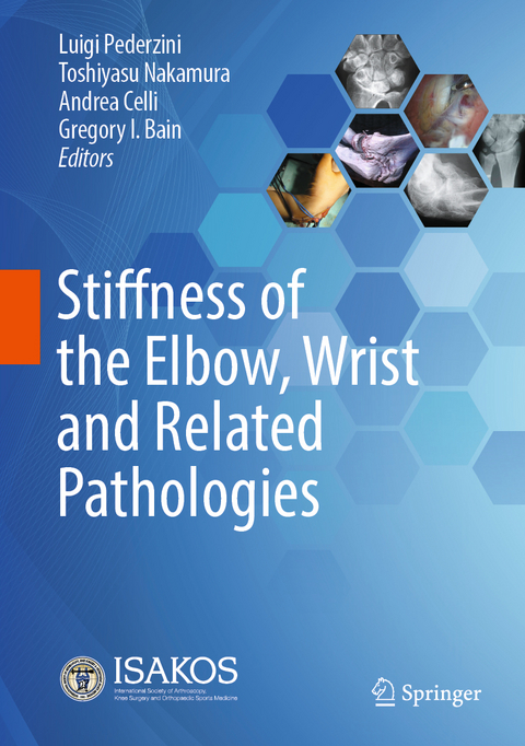 Stiffness of the Elbow, Wrist and Related Pathologies - 