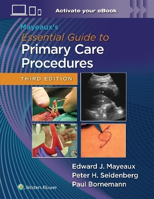 Mayeaux's Essential Guide to Primary Care Procedures: Print + eBook with Multimedia - EDWARD JOHN MAYEAUX, Paul Bornemann, Peter H. Seidenberg