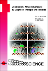 Glioblastom: Aktuelle Konzepte zu Diagnose, Therapie und TTFields - Martin Glas