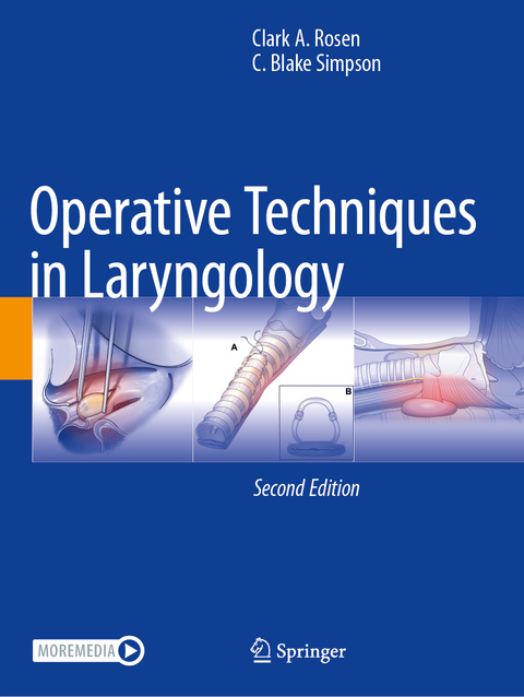 Operative Techniques in Laryngology - Clark A. Rosen, C. Blake Simpson