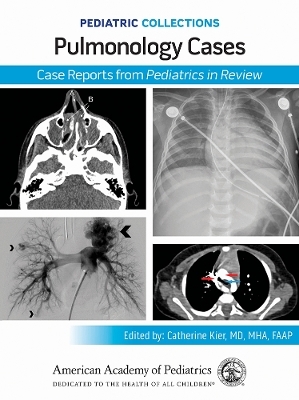 Pulmonology Cases - 