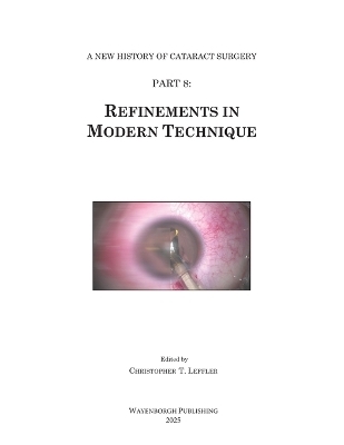 History of Cataract Surgery