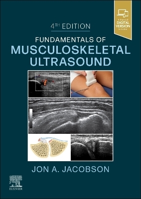 Fundamentals of Musculoskeletal Ultrasound